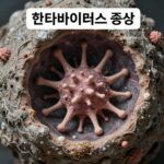 한타바이러스 증상 설명 이미지
