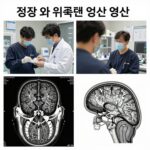 정상 뇌와 위축된 뇌의 MRI 영상 비교, 뇌 위축 진단에 사용되는 의료 이미지