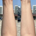 다리털 숱제거기 사용법 후기 다리털 숱제거기 사용 전과 후의 비교 사진. 왼쪽은 정리 전 무성한 다리털, 오른쪽은 정리 후 깔끔해진 다리 모습.