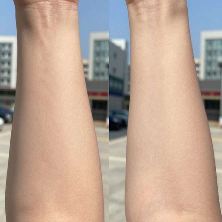 다리털 숱제거기 사용 전과 후의 비교 사진. 왼쪽은 정리 전 무성한 다리털, 오른쪽은 정리 후 깔끔해진 다리 모습.