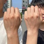 복숭아 알레르기 증상 빠르게 확인 복숭아를 손에 들고 있는 모습과 피부 발진 비교 사진